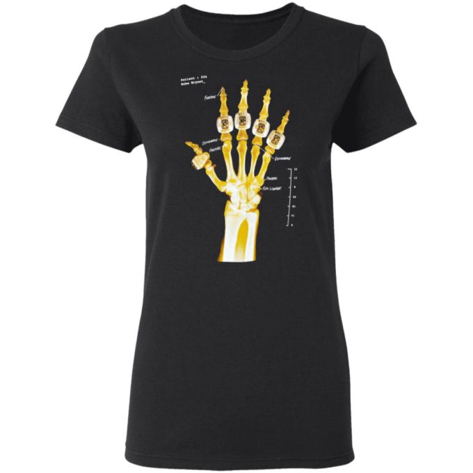 Kobe Bryant Hand Gold Rings X-Ray T-Shirt, Ls, Hoodie 5