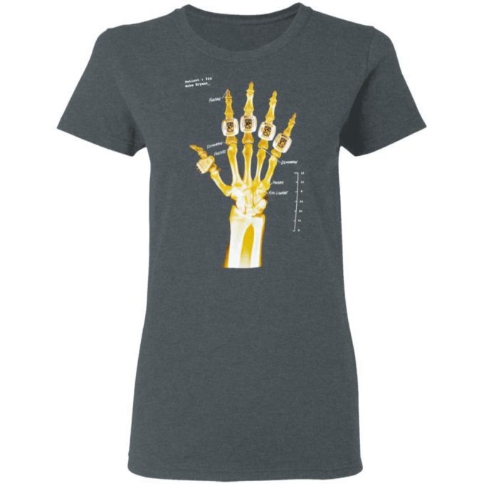 Kobe Bryant Hand Gold Rings X-Ray T-Shirt, Ls, Hoodie 6